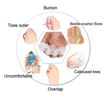 Load image into Gallery viewer, Orthopedic Bunion Corrector 2.0 (1 pair)