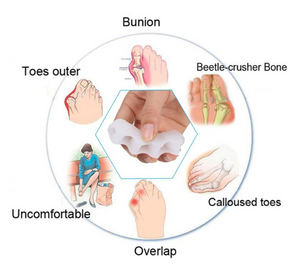 Orthopedic Bunion Corrector 2.0 (1 pair)