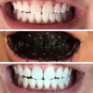Activated Charcoal Toothpaste